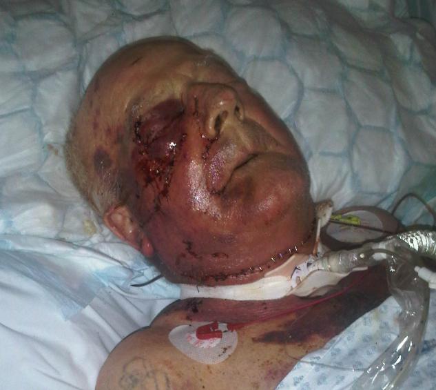 Tommy Ward Maltby Pensioner Injuries 