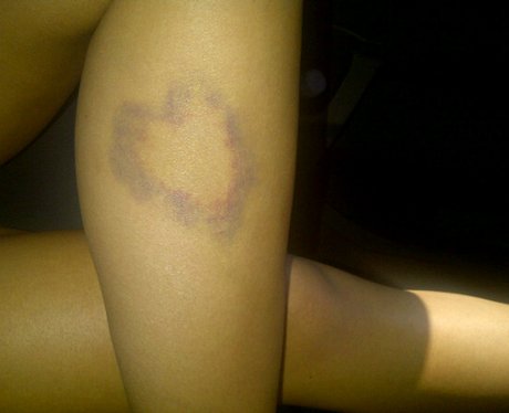 Twitpics