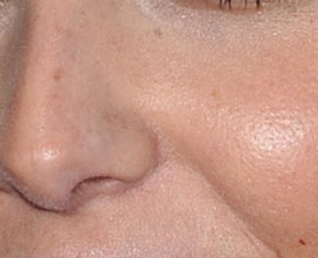 Whose nose is this?