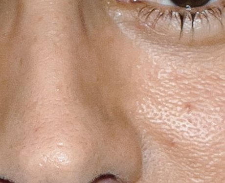 Whose nose is this?