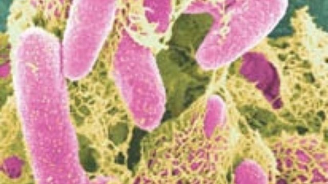 E-coli in colour