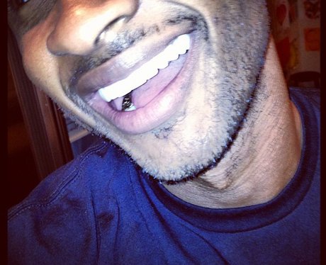 Usher's gold teeth