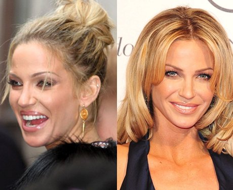 Bad Hair Day: Sarah Harding