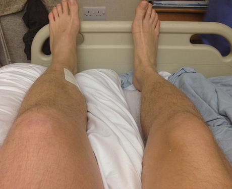 Professor Green Swollen Leg
