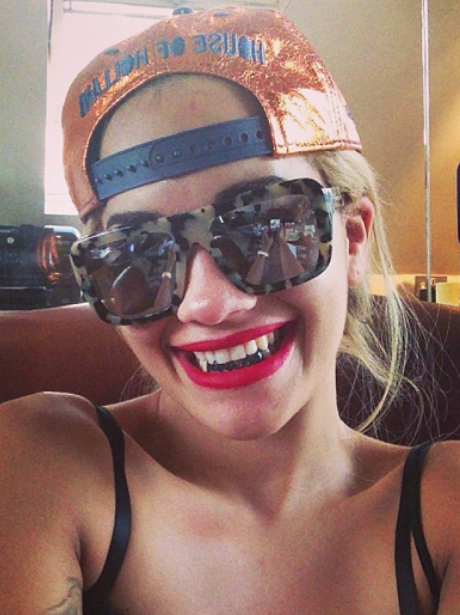 Rita Ora teeth grilz