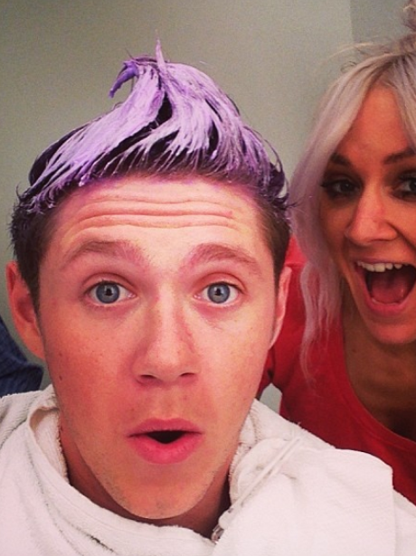 Niall Horan hair dye