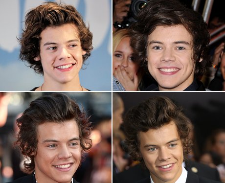 Harry Styles Teeth