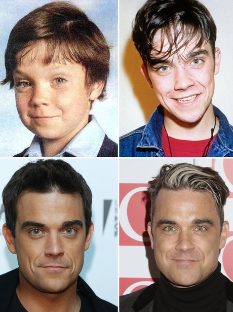 celebrity Transformations: Robbie Williams