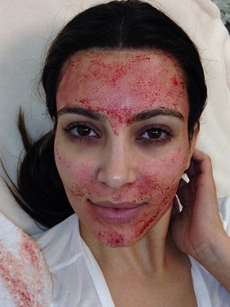 Kim Kardashian blod selfie