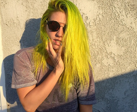 Kesha with yellow hair
