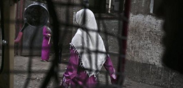 FGM