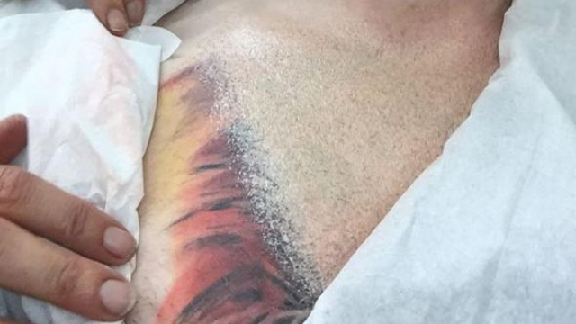Ed Sheeran shows off HUGE new tattoo that hints at how many kids he wants   Irish Mirror Online