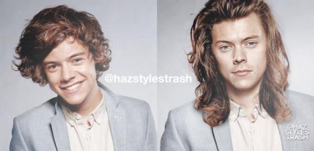 Harry Styles Then And Now 