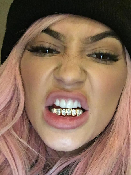 Kylie Jenner shows off gold Grills on Instagram