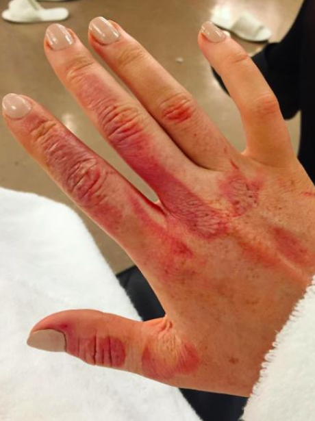 Perrie Edwards Burn Instagram