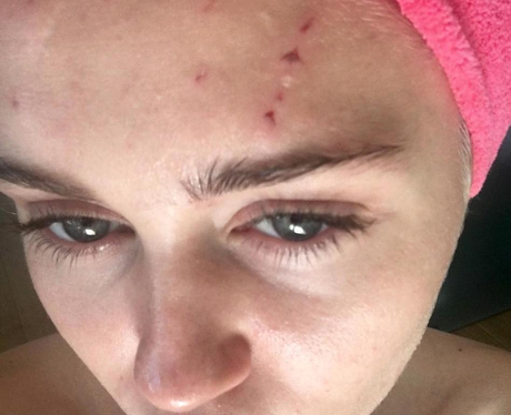 Miley Cyrus attacked by a cat