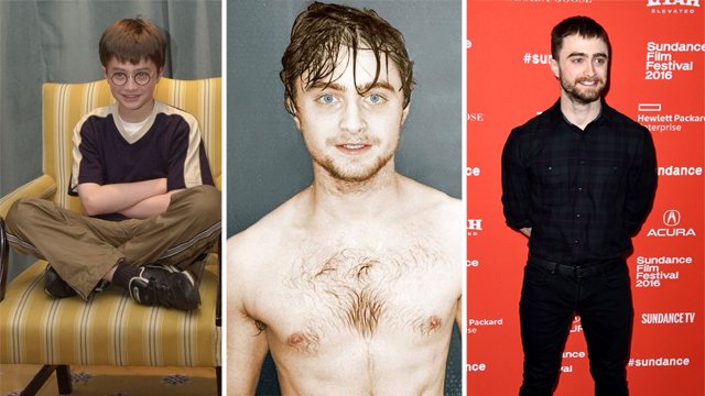 19 Pics Charting Daniel Radcliffe’s MIND-BLOWING Transformation Over ...