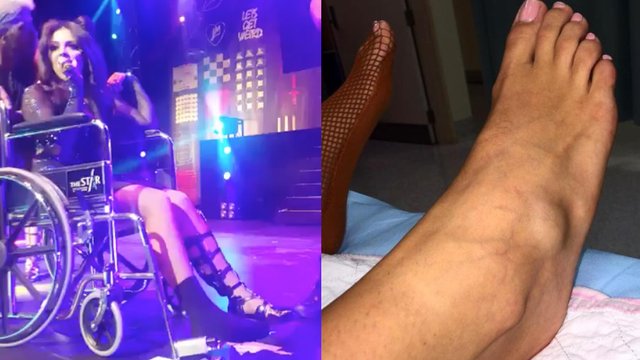 Jesy Nelson Little Mix torn ligament wheelchair