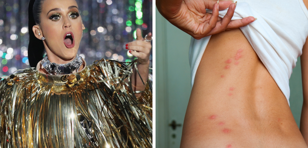 Katy Perry Bite Marks