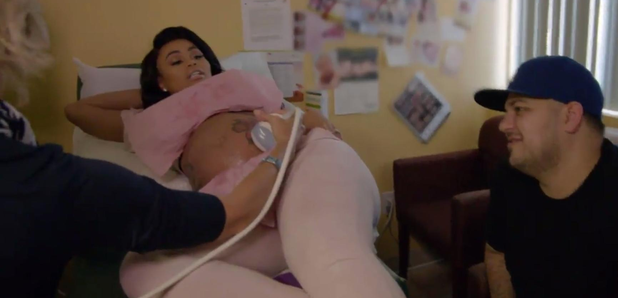 Blac Chyna Rob Kardashian ultrasound scan