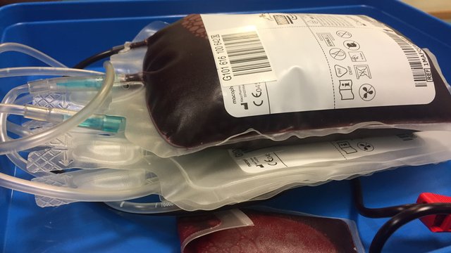 A pouch of blood which has been donated