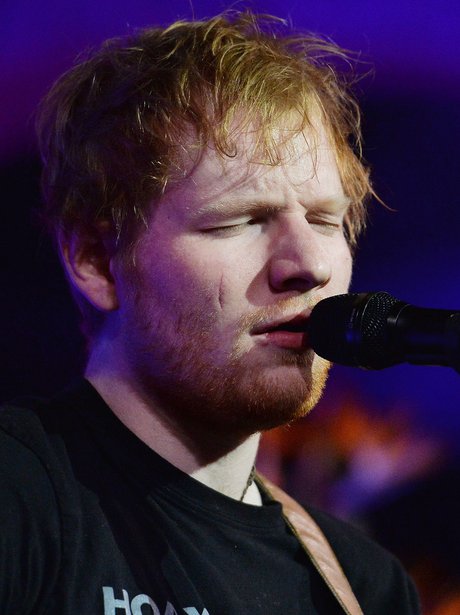 Ed Sheeran performs and shows off scar from incide