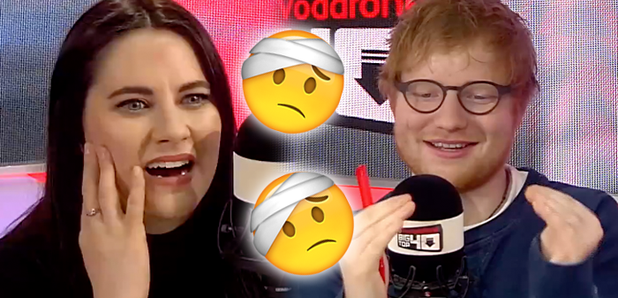 Ed Sheeran Big Top 40 Studio injury story