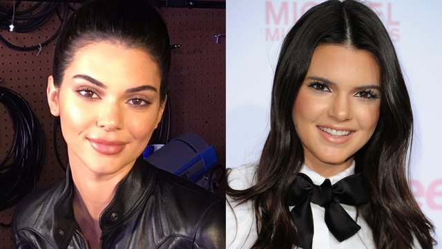 Kendall Jenner Before and After 