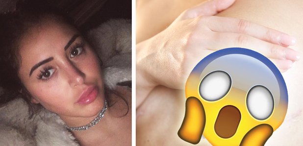 Marnie Simpson Botched boobs