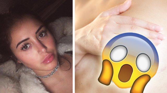 Marnie Simpson's Opened Up About Her Botched Boob Job & The Pics Will Make  You Wince! - Capital