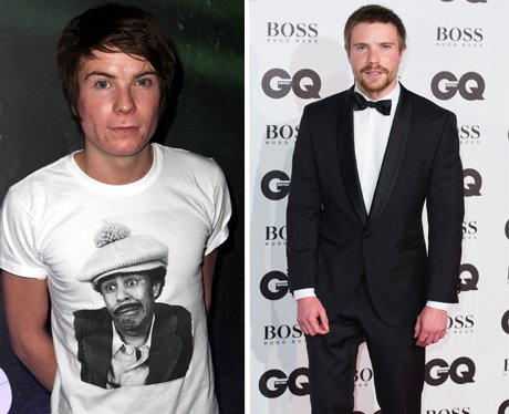 Skins Cast Then and Now Joe Dempsie
