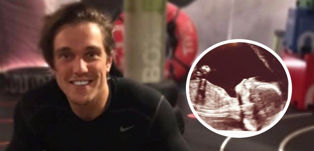 Lewis Bloor baby scan 