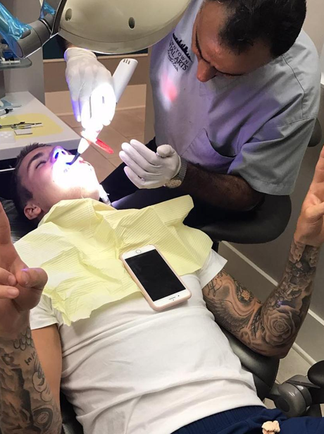 Justin Bieber chipped a tooth whilst boxing so had