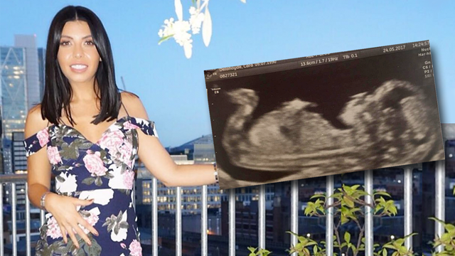 Cara De La Hoyde Shares Baby Scan