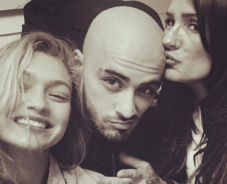 Zayn Malik's Bald Head