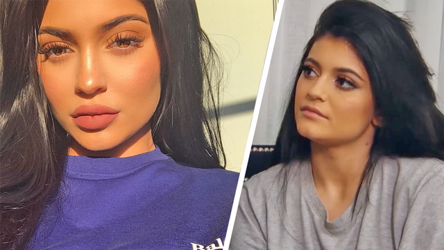 “it’s Been An Insecurity All My Life”: Kylie Jenner Reveals The Real 