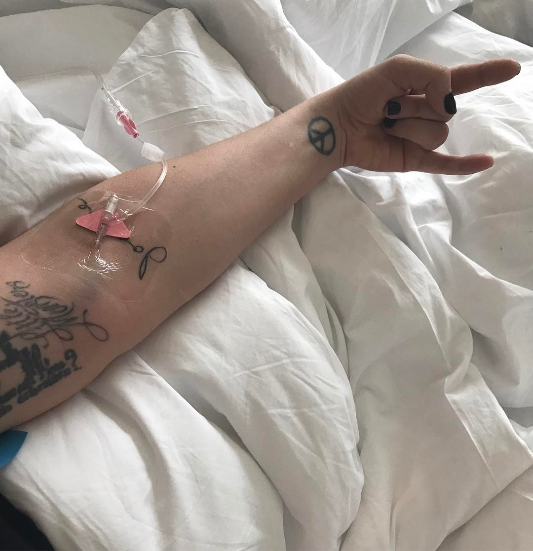 Lady Gaga Illness Arm