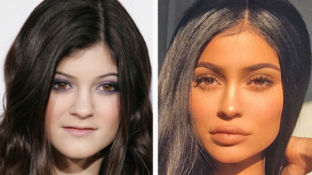 Kylie Jenner Then & Now