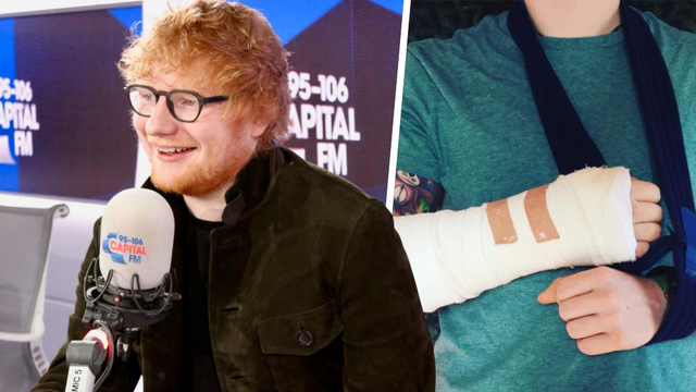 Ed Sheeran Broken Arm Songs