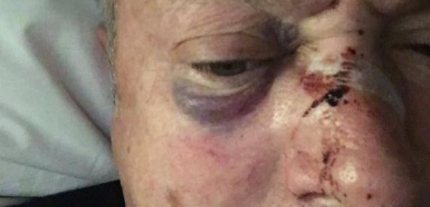 Nick Nairn assault