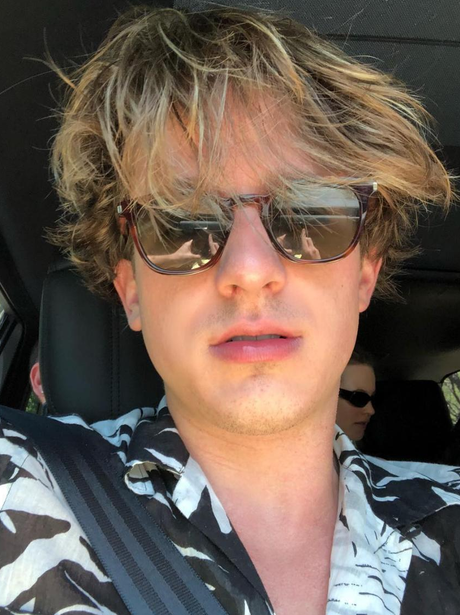 Charlie Puth Dyes Hair