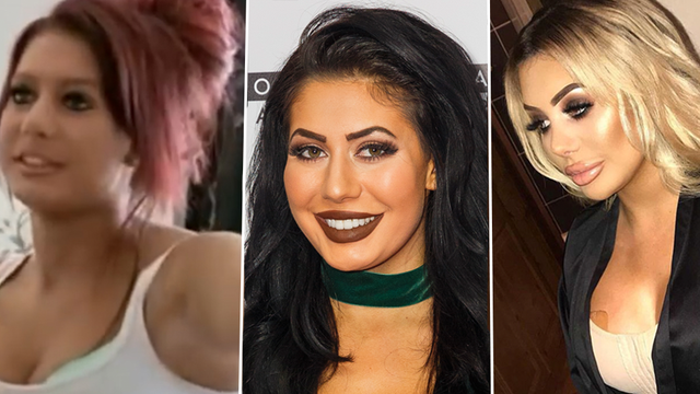 Geordie Shores Chloe Ferry Surgery Timeline Before And After Pictures 
