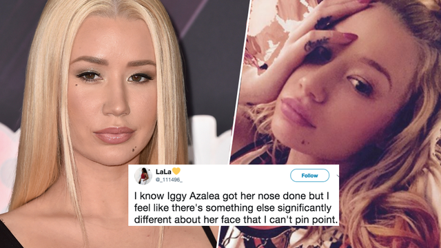 Iggy Azalea Surgery Rumours