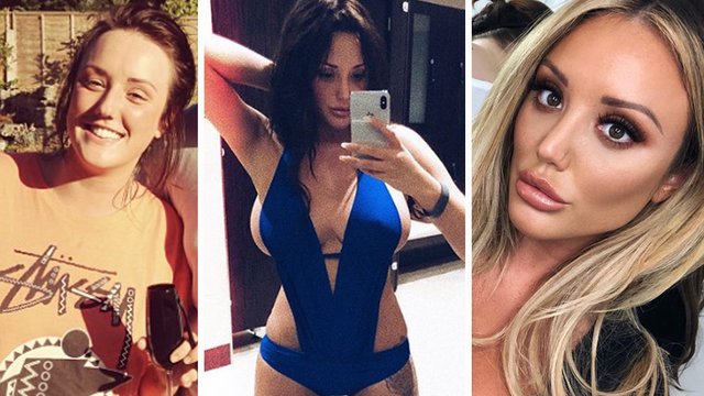 Charlotte Crosby surgery timeline 