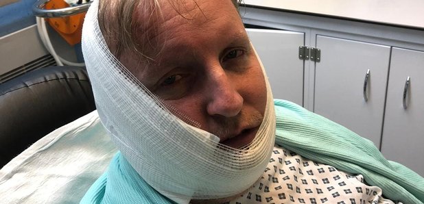 Mike Glover-Johnson Bloxwich Walsall acid attack