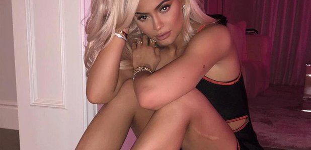 How Did Kylie Jenner Get Her Leg Scar? Childhood Injury Details