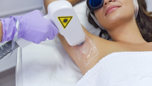 Laser Hair Removal Generic