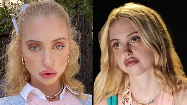 Chloe Cherry 14 Facts About The Euphoria Actress You Probably Didn t Chloe Cherry 14 Facts About The Euphoria Actress You Probably Didn t